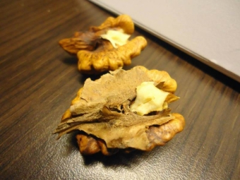  Treatment of the thyroid gland with walnut septum